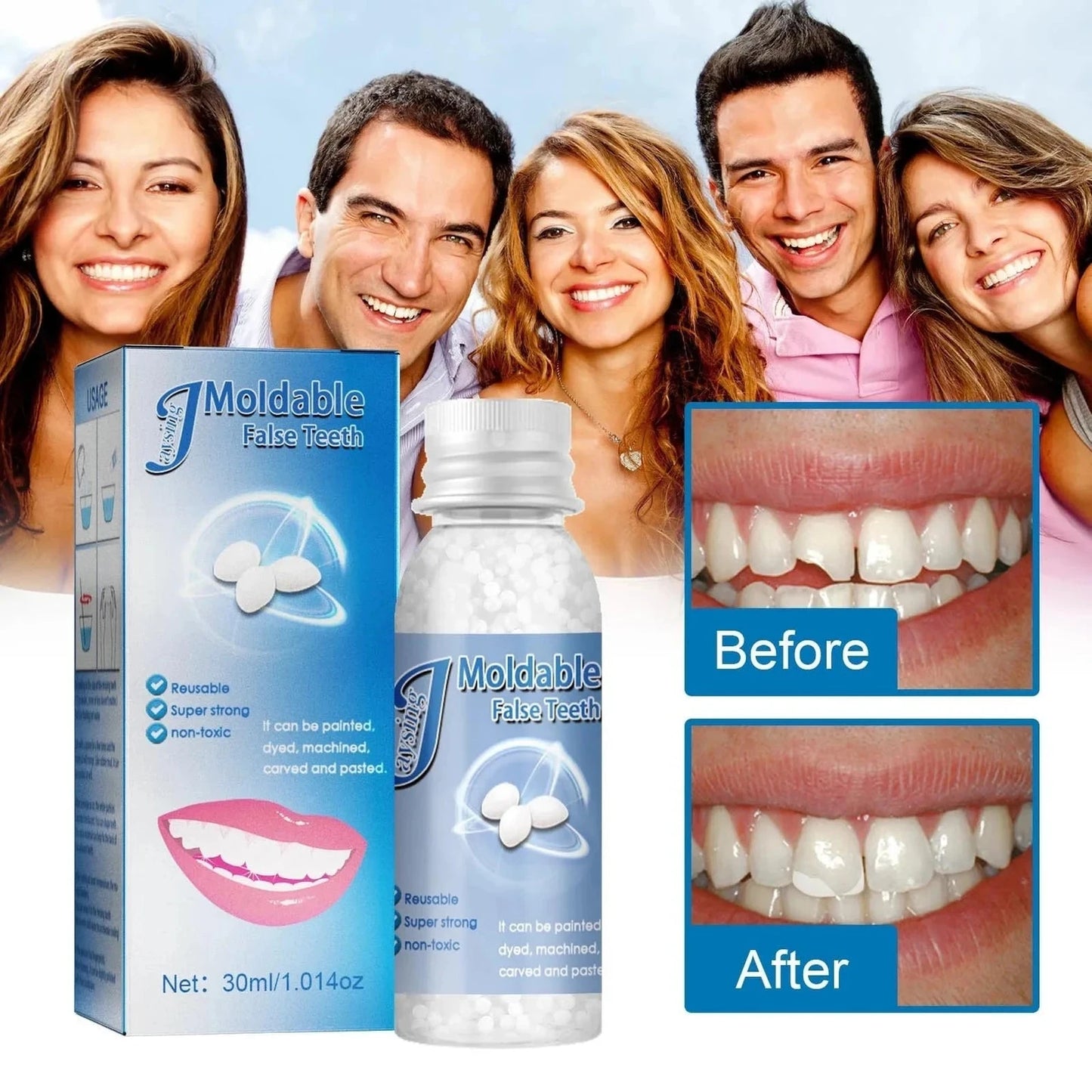 Resina Dental Moldeable: Sonrie Sin Miedo 😁